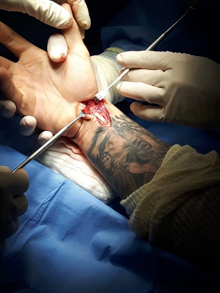 patricky pitbull cirurgia1