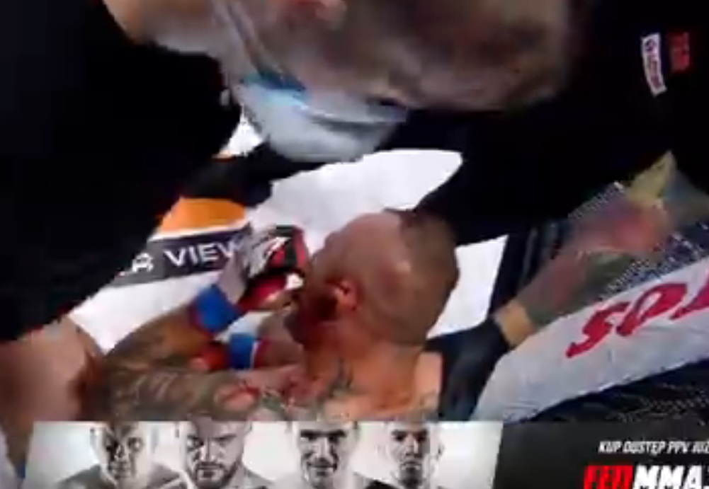 Imagens fortes: assim como no Taura e UFC, lutador de evento polonês fica com a orelha pendurada após receber golpe