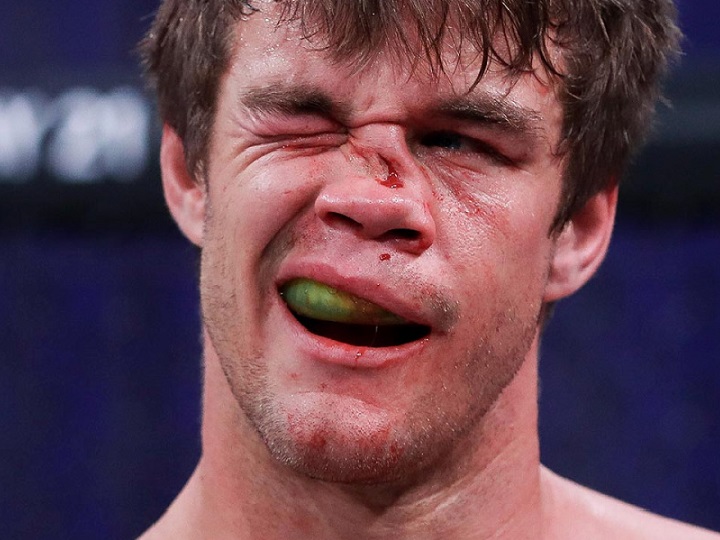 Além de nariz ‘amassado’, lutador revela que quebrou a mão em duelo contra Michael Page no Bellator 258