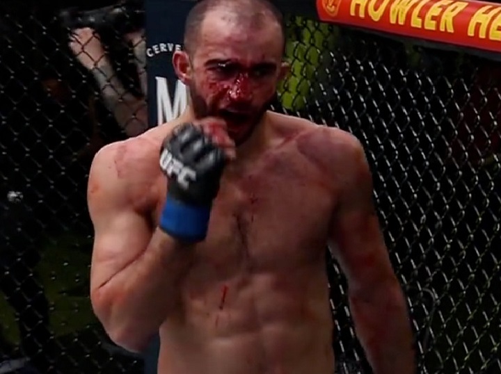 Derrotado no UFC Vegas, lutador fica com rosto desfigurado após sofrer duras cotoveladas