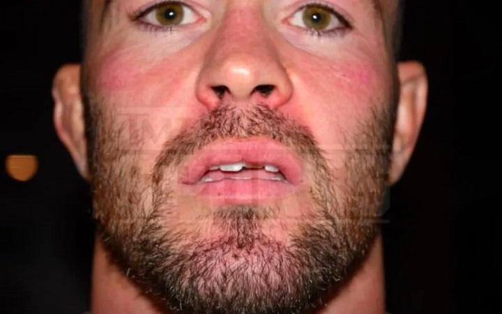 Colby Covington teria tido seu dente quebrado em suposta agressão de Jorge Masvidal (Foto: Reprodução/TMZ Sports)