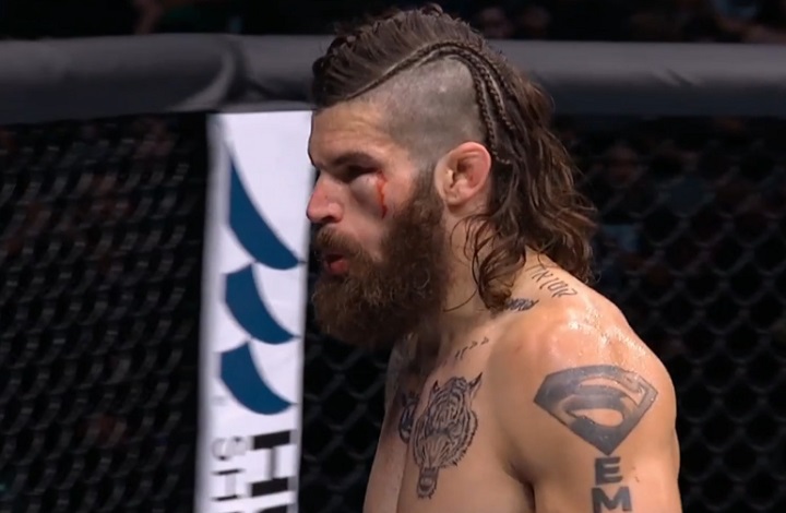 UFC 277: lutador fica com o olho ‘desfigurado’ e totalmente inchado durante duelo; confira imagens