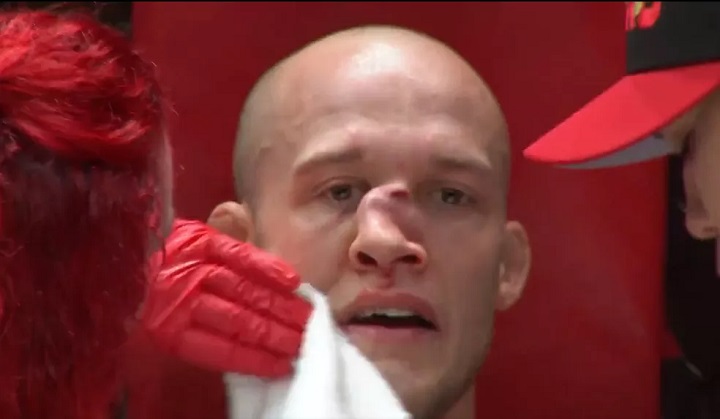 Lutador de MMA ficou com o nariz completamente torto após receber uma joelhada do seu adversário (Foto: Reprodução)
