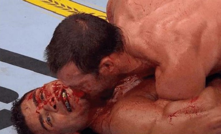 Paulo Borrachinha contou sua reação após Rockhold ter esfregado sangue em seu rosto (Foto: Reprodução/UFC)
