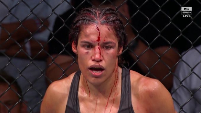 Após rosto desfigurado no UFC 277, Peña desmente Dana: ‘Apenas um arranhão, nenhum pedaço faltando’