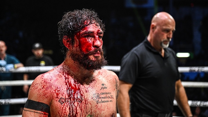 Diego Sanchez, ex-UFC, foi derrotado em sua estreia no Boxe sem luvas (Foto: Phil Lambert/BKFC)