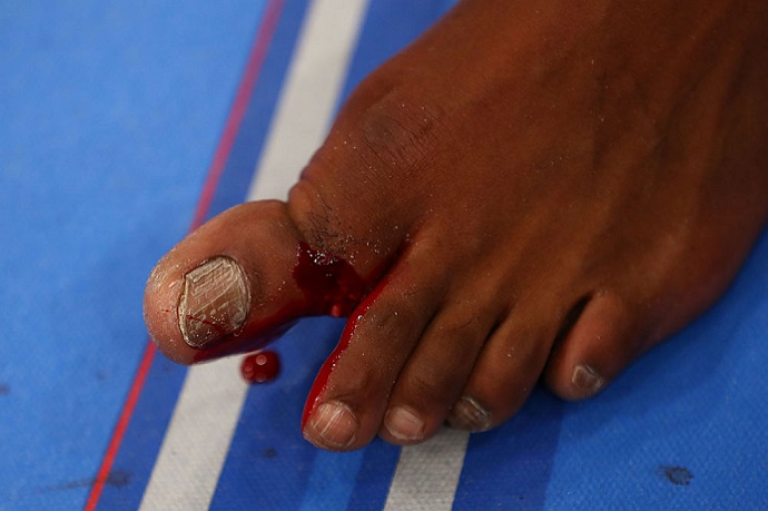 Jon Jones fraturou o dedão do pé esquerdo durante luta contra Sonnen (Foto: Divulgação/UFC)