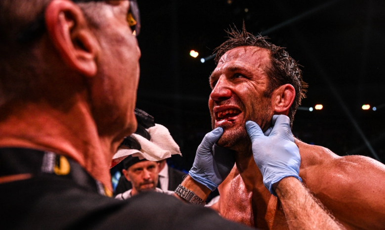 Rockhold ficou com a boca mutilada após luta com Perry (Foto: Divulgação/BKFC)