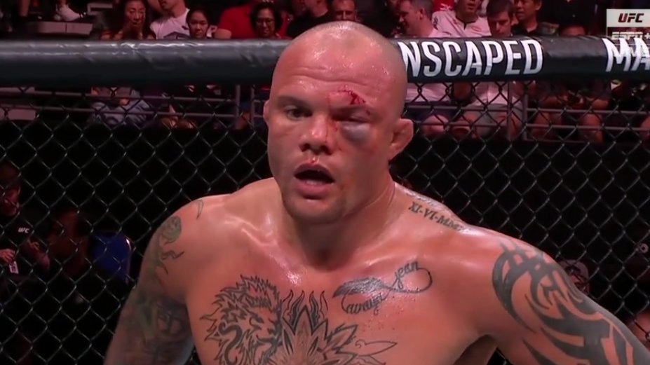 Anthony Smith saiu bastante machucado, mas venceu Ryan Spann no co-main-event do UFC Singapura, por decisão dividida (Foto: Reprodução/ESPN)