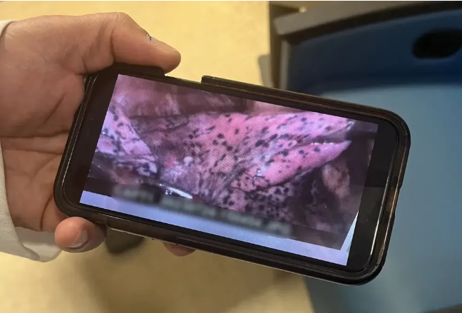 Lutador de MMA precisa remover pulmão direito após uso de cigarro eletrônico: 'Tinha o melhor cardio' 1 Screenshot 2023 08 15 at 15 53 57 Aspirante a lutador de MMA perde parte do pulmao por conta do uso de vape
