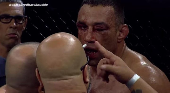 Fabricio Werdum ficou bastante machucado após derrota para Junior Cigano no MMA sem luvas (Foto: Reprodução)