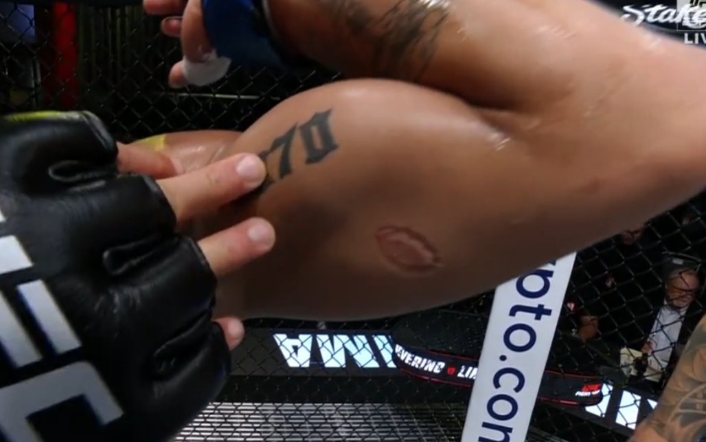 André Mascote teve o braço mordido por Igor Severino do UFC Vegas 89 e venceu o duelo por desclassificação (Foto: Reprodução)