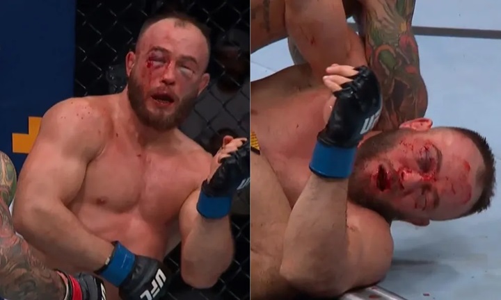 UFC St. Louis: sem conseguir abrir os olhos, polonês mostra ‘estrago’ após derrota para brasileiro