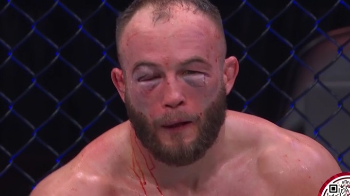 Derrotado por Diego Ferreira no UFC St. Louis, Mateusz Rebecki terminou o duelo bastante machucado (Foto: Reprodução/UFC)