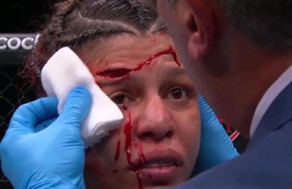 Mayra Sheetara sofre corte assustador no UFC 303 e árbitro decide encerrar a luta; confira
