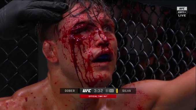 Em ação no UFC Denver, Jean Silva volta a vencer após 15 dias e deixa adversário desfigurado